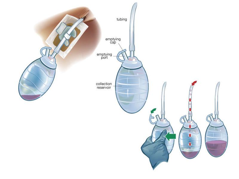 JP Drain Anatomy